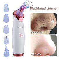 Electric Blackhead and Pimple Extractor